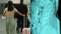 O româncă a fost arestată pe un aeroport din Italia. Incredibil ce ascundea femeia în stomac O româncă a fost arestată pe un aeroport din Italia. Incredibil ce ascundea femeia în stomac